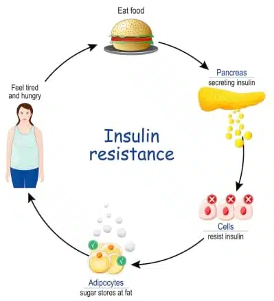 insuline-cirkel-00050rrrwfv